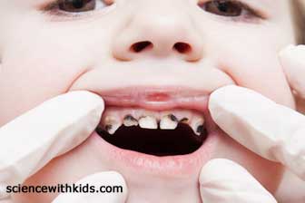 gross teeth